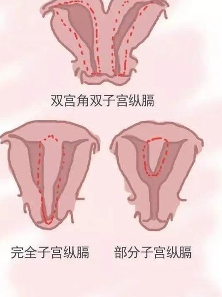 惠州试管婴儿价格多少费用，惠州试管婴儿费用大约多少！
