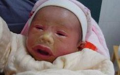 高龄做试管婴儿失败的原因分析，子宫、胚胎关系都不小