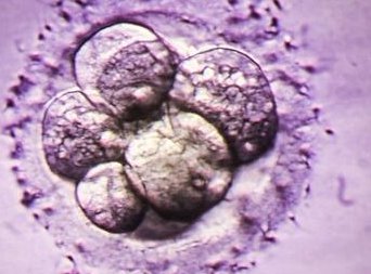 毕节特需医院大全，2026贵州试管婴儿成功率前十排名